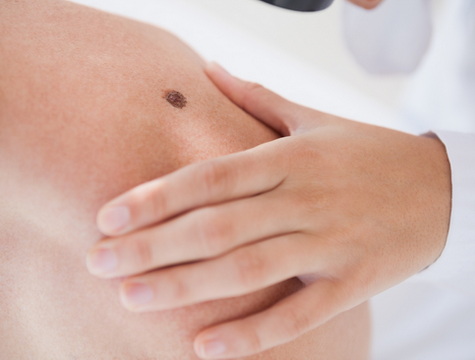 Dermatologija